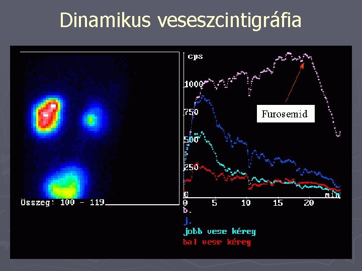 Dinamikus veseszcintigráfia 