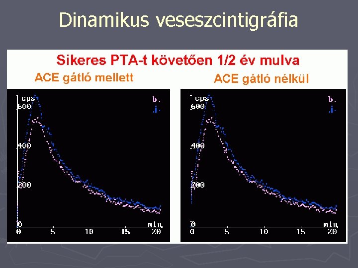 Dinamikus veseszcintigráfia 