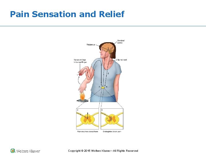 Pain Sensation and Relief Copyright © 2015 Wolters Kluwer • All Rights Reserved Pain Sensation and Relief Copyright © 2015 Wolters Kluwer • All Rights Reserved