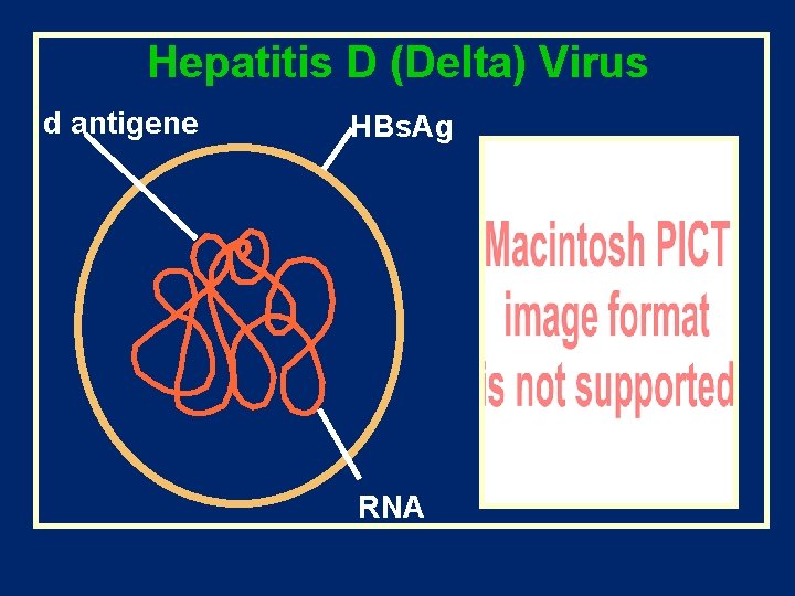 Hepatitis D (Delta) Virus d antigene HBs. Ag RNA 