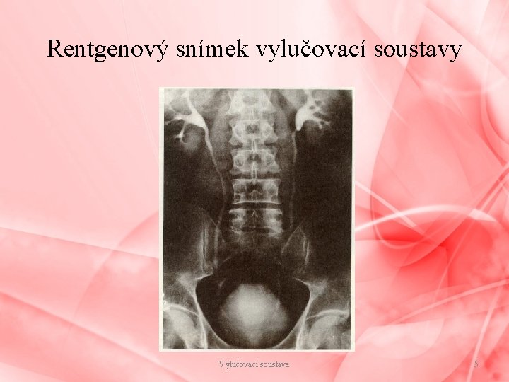 Rentgenový snímek vylučovací soustavy Vylučovací soustava 5 