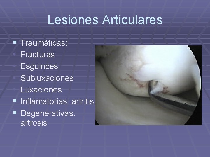 Lesiones Articulares § • • § § Traumáticas: Fracturas Esguinces Subluxaciones Luxaciones Inflamatorias: artritis Lesiones Articulares § • • § § Traumáticas: Fracturas Esguinces Subluxaciones Luxaciones Inflamatorias: artritis