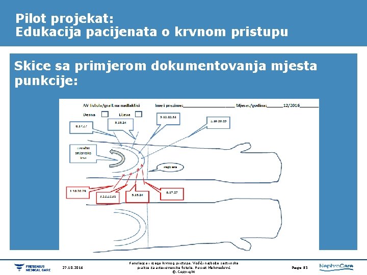 Pilot projekat: Edukacija pacijenata o krvnom pristupu Skice sa primjerom dokumentovanja mjesta punkcije: 27. Pilot projekat: Edukacija pacijenata o krvnom pristupu Skice sa primjerom dokumentovanja mjesta punkcije: 27.