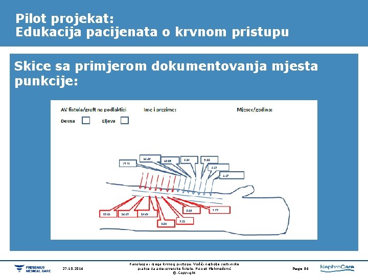 Pilot projekat: Edukacija pacijenata o krvnom pristupu Skice sa primjerom dokumentovanja mjesta punkcije: 27. Pilot projekat: Edukacija pacijenata o krvnom pristupu Skice sa primjerom dokumentovanja mjesta punkcije: 27.