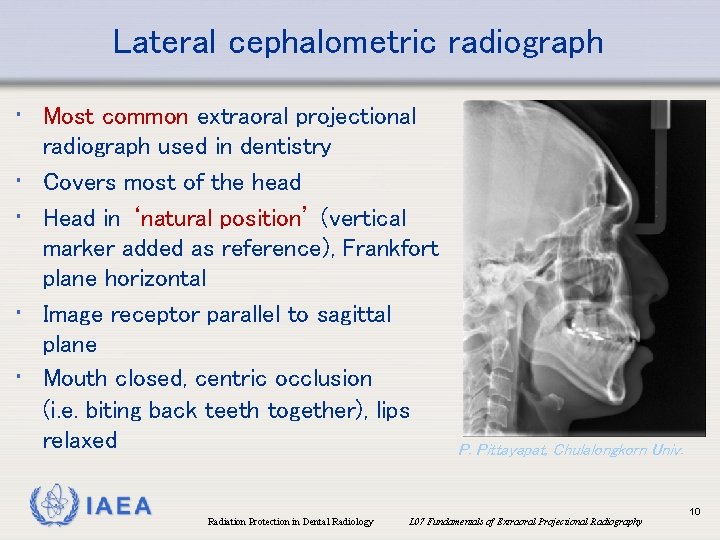 Lateral cephalometric radiograph • Most common extraoral projectional • • radiograph used in dentistry