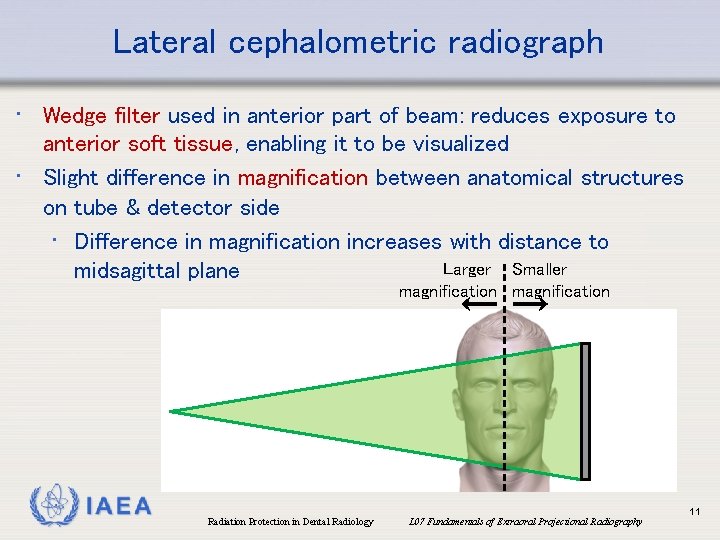 Lateral cephalometric radiograph • Wedge filter used in anterior part of beam: reduces exposure