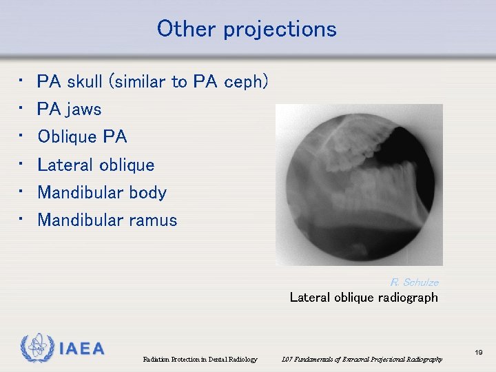 Other projections • • • PA skull (similar to PA ceph) PA jaws Oblique