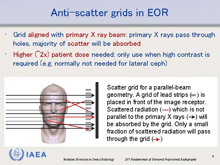 Anti-scatter grids in EOR • Grid aligned with primary X ray beam: primary X