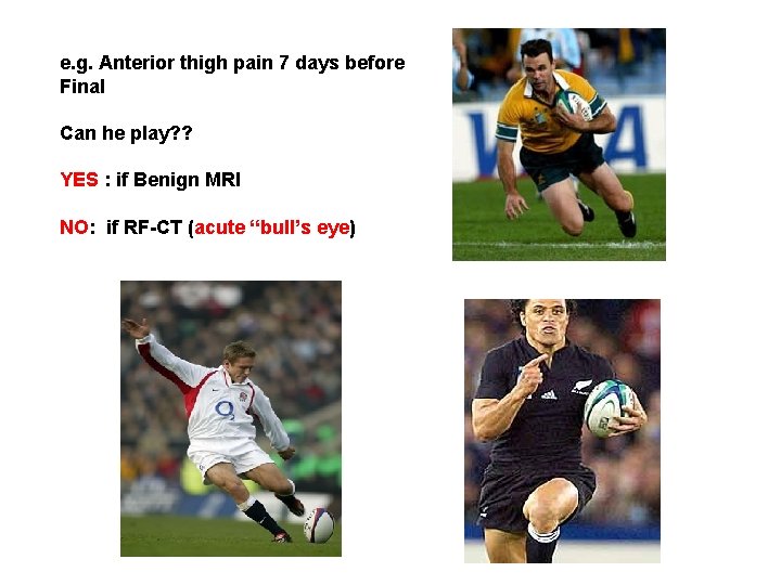 e. g. Anterior thigh pain 7 days before Final Can he play? ? YES