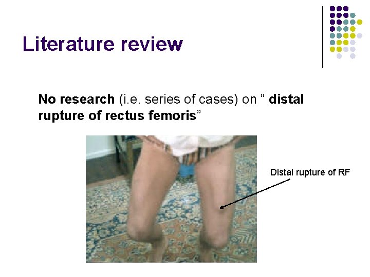 Literature review No research (i. e. series of cases) on “ distal rupture of