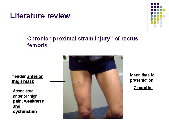 Literature review Chronic “proximal strain injury” of rectus femoris Tender anterior thigh mass Associated