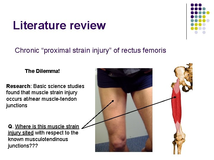 Literature review Chronic “proximal strain injury” of rectus femoris The Dilemma! Research: Basic science