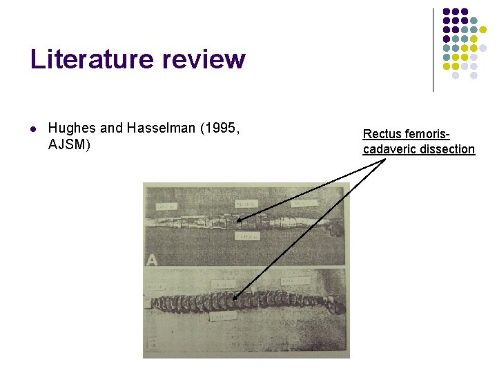 Literature review l Hughes and Hasselman (1995, AJSM) Rectus femoriscadaveric dissection 