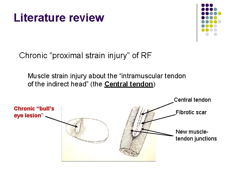 Literature review Chronic “proximal strain injury” of RF Muscle strain injury about the “intramuscular