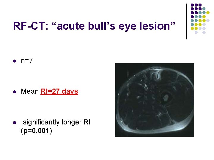 RF-CT: “acute bull’s eye lesion” l n=7 l Mean RI=27 days l significantly longer