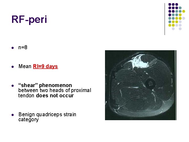 RF-peri l n=8 l Mean RI=9 days l “shear” phenomenon between two heads of