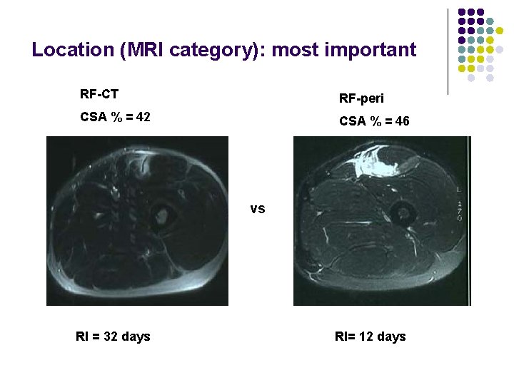 Location (MRI category): most important RF-CT RF-peri CSA % = 42 CSA % =