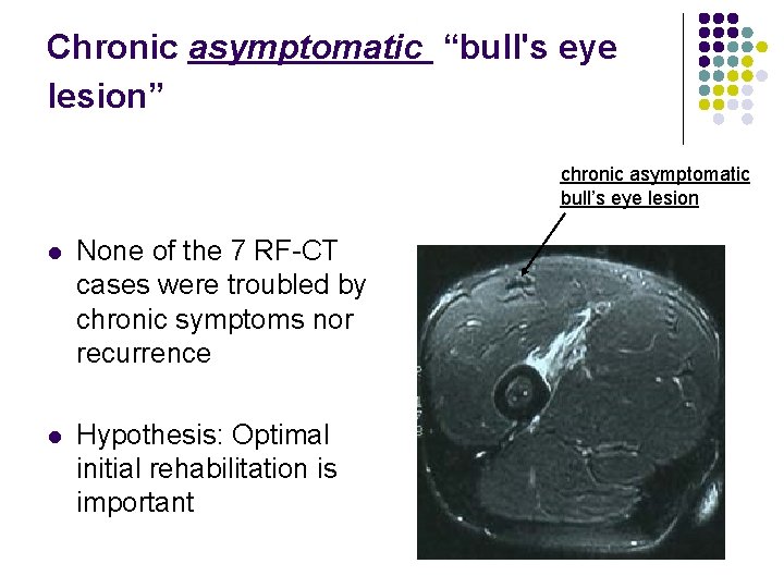 Chronic asymptomatic “bull's eye lesion” chronic asymptomatic bull’s eye lesion l None of the