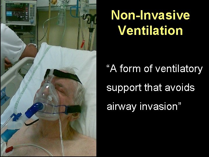 Non-Invasive Ventilation “A form of ventilatory support that avoids airway invasion” Non-Invasive Ventilation “A form of ventilatory support that avoids airway invasion”