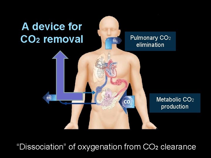 A device for CO 2 removal Pulmonary CO 2 elimination Metabolic CO 2 production A device for CO 2 removal Pulmonary CO 2 elimination Metabolic CO 2 production