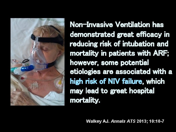 Non-Invasive Ventilation has demonstrated great efficacy in reducing risk of intubation and mortality in Non-Invasive Ventilation has demonstrated great efficacy in reducing risk of intubation and mortality in