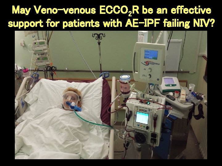May Veno-venous ECCO 2 R be an effective support for patients with AE-IPF failing May Veno-venous ECCO 2 R be an effective support for patients with AE-IPF failing