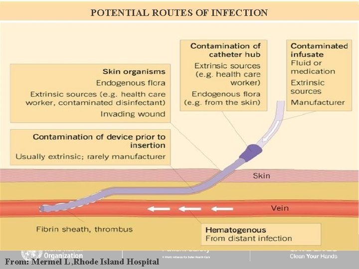POTENTIAL ROUTES OF INFECTION From: Mermel L , Rhode Island Hospital 