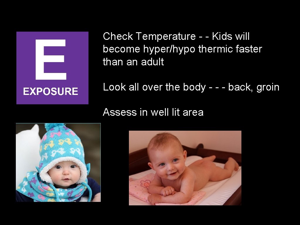 Check Temperature - - Kids will become hyper/hypo thermic faster than an adult Look Check Temperature - - Kids will become hyper/hypo thermic faster than an adult Look
