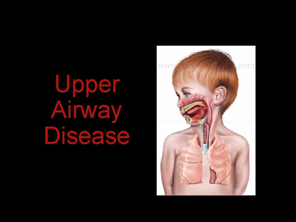 Upper Airway Disease Upper Airway Disease