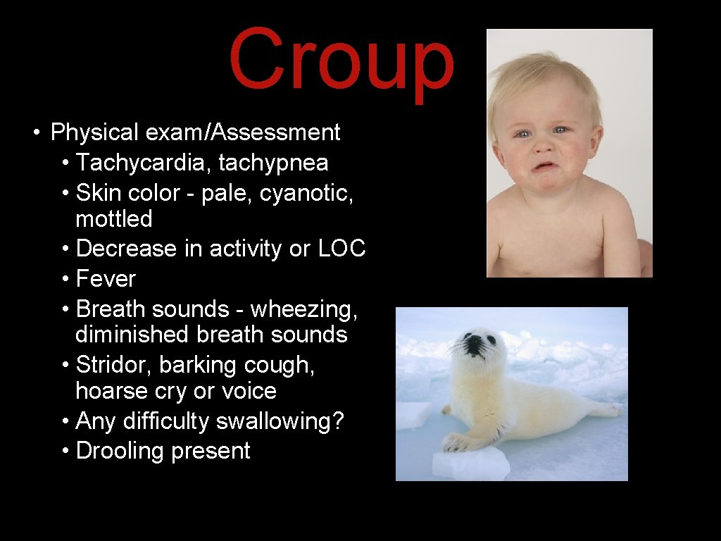 Croup • Physical exam/Assessment • Tachycardia, tachypnea • Skin color - pale, cyanotic, mottled Croup • Physical exam/Assessment • Tachycardia, tachypnea • Skin color - pale, cyanotic, mottled