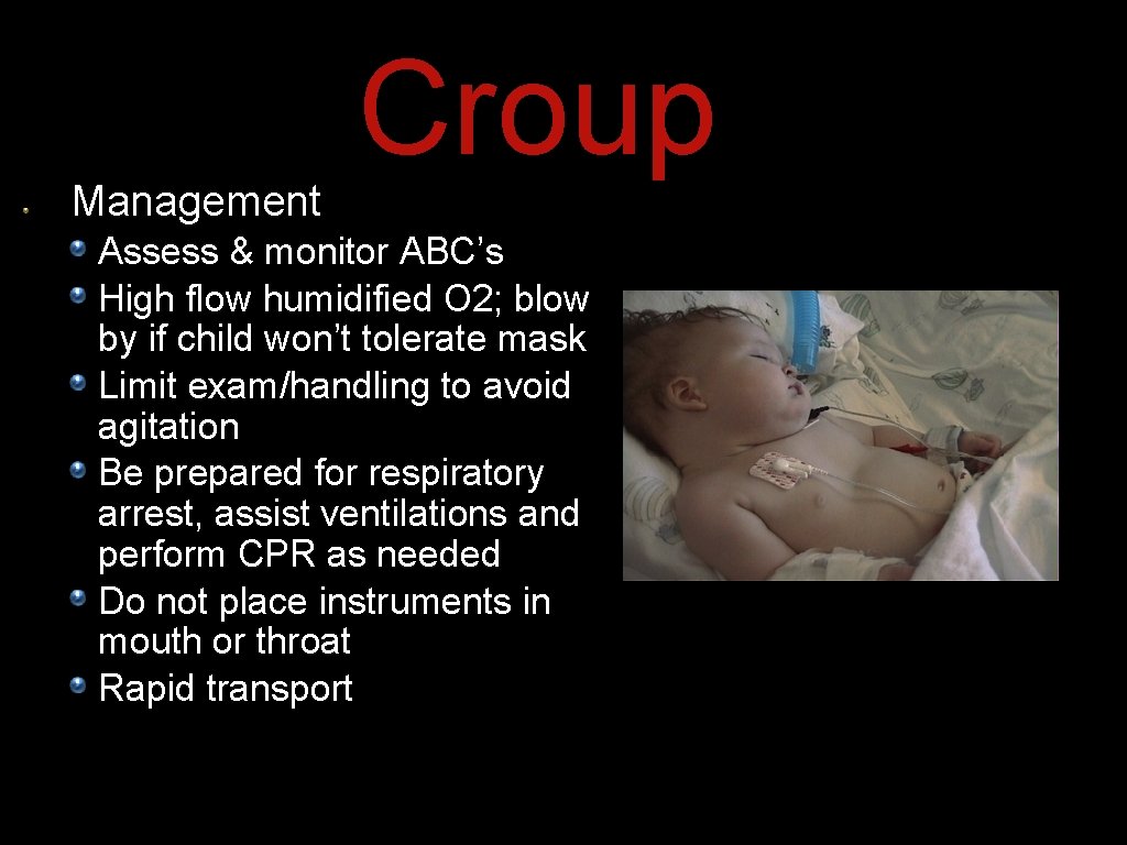 Management Croup Assess & monitor ABC’s High flow humidified O 2; blow by if Management Croup Assess & monitor ABC’s High flow humidified O 2; blow by if
