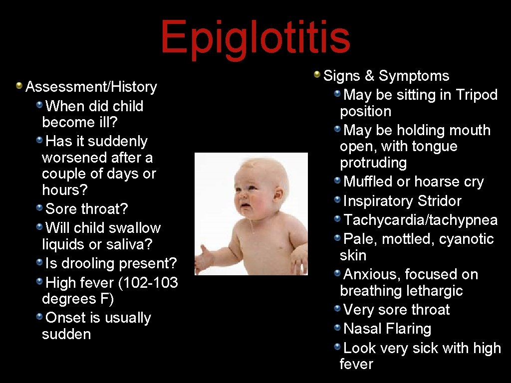 Epiglotitis Assessment/History When did child become ill? Has it suddenly worsened after a couple Epiglotitis Assessment/History When did child become ill? Has it suddenly worsened after a couple