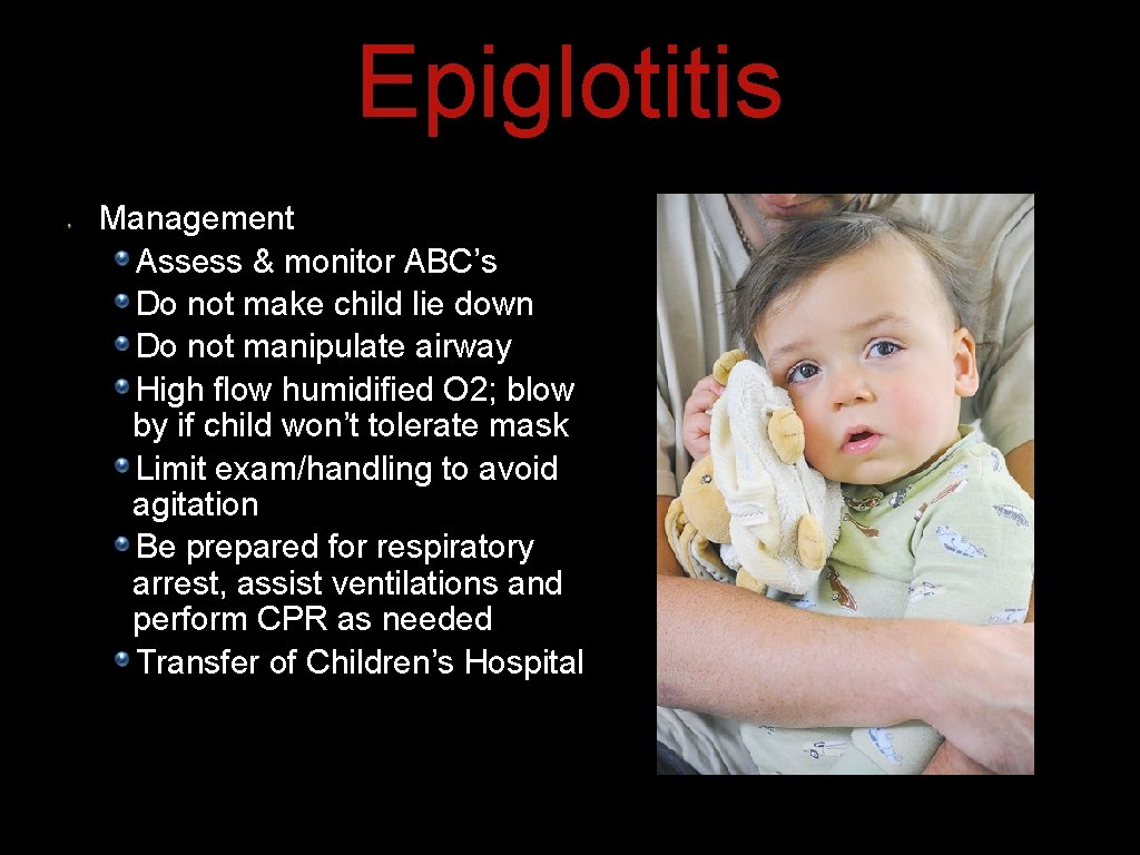 Epiglotitis Management Assess & monitor ABC’s Do not make child lie down Do not Epiglotitis Management Assess & monitor ABC’s Do not make child lie down Do not