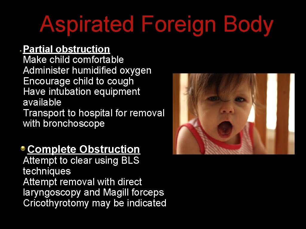 Aspirated Foreign Body Partial obstruction Make child comfortable Administer humidified oxygen Encourage child to Aspirated Foreign Body Partial obstruction Make child comfortable Administer humidified oxygen Encourage child to