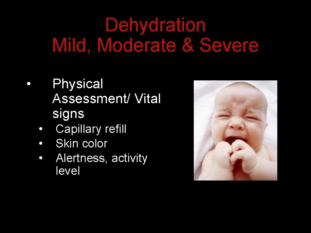 Dehydration Mild, Moderate & Severe • Physical Assessment/ Vital signs • • • Capillary Dehydration Mild, Moderate & Severe • Physical Assessment/ Vital signs • • • Capillary