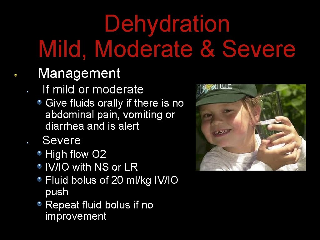 Dehydration Mild, Moderate & Severe Management If mild or moderate Give fluids orally if Dehydration Mild, Moderate & Severe Management If mild or moderate Give fluids orally if
