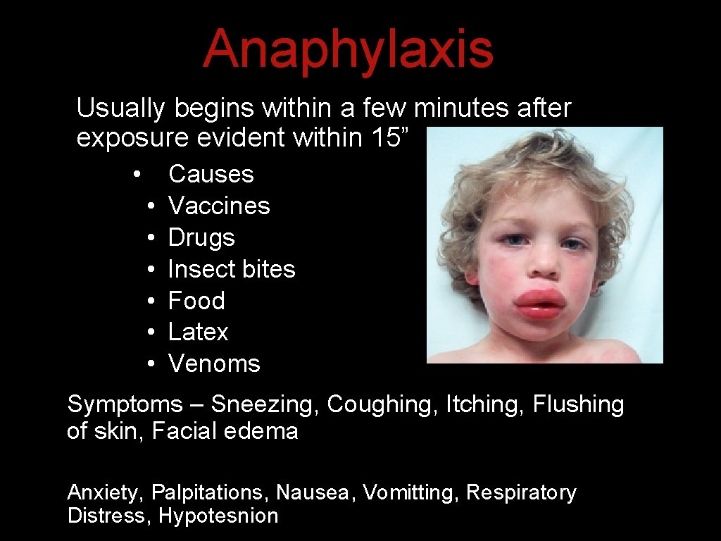 Anaphylaxis Usually begins within a few minutes after exposure evident within 15” • • Anaphylaxis Usually begins within a few minutes after exposure evident within 15” • •