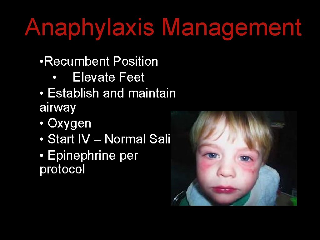 Anaphylaxis Management • Recumbent Position • Elevate Feet • Establish and maintain airway • Anaphylaxis Management • Recumbent Position • Elevate Feet • Establish and maintain airway •
