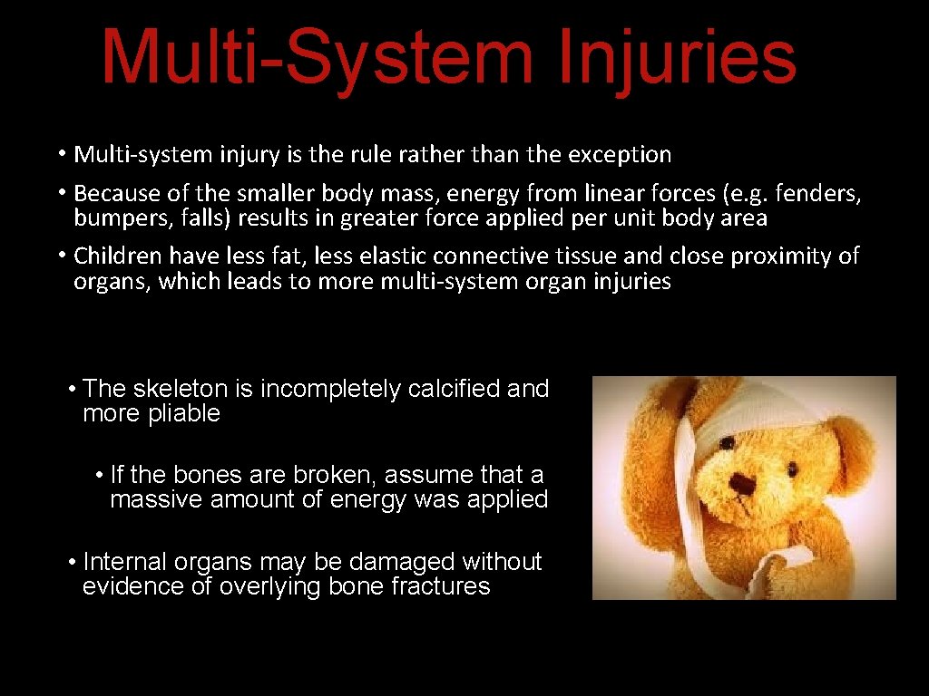 Multi-System Injuries • Multi-system injury is the rule rather than the exception • Because Multi-System Injuries • Multi-system injury is the rule rather than the exception • Because