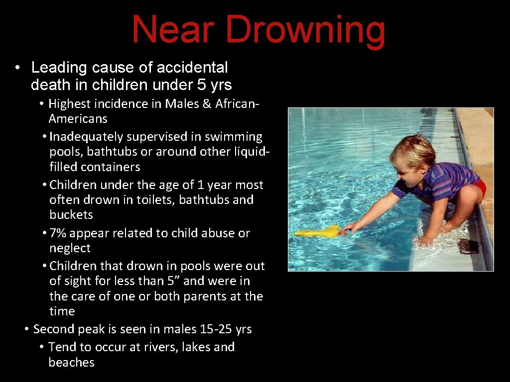 Near Drowning • Leading cause of accidental death in children under 5 yrs • Near Drowning • Leading cause of accidental death in children under 5 yrs •