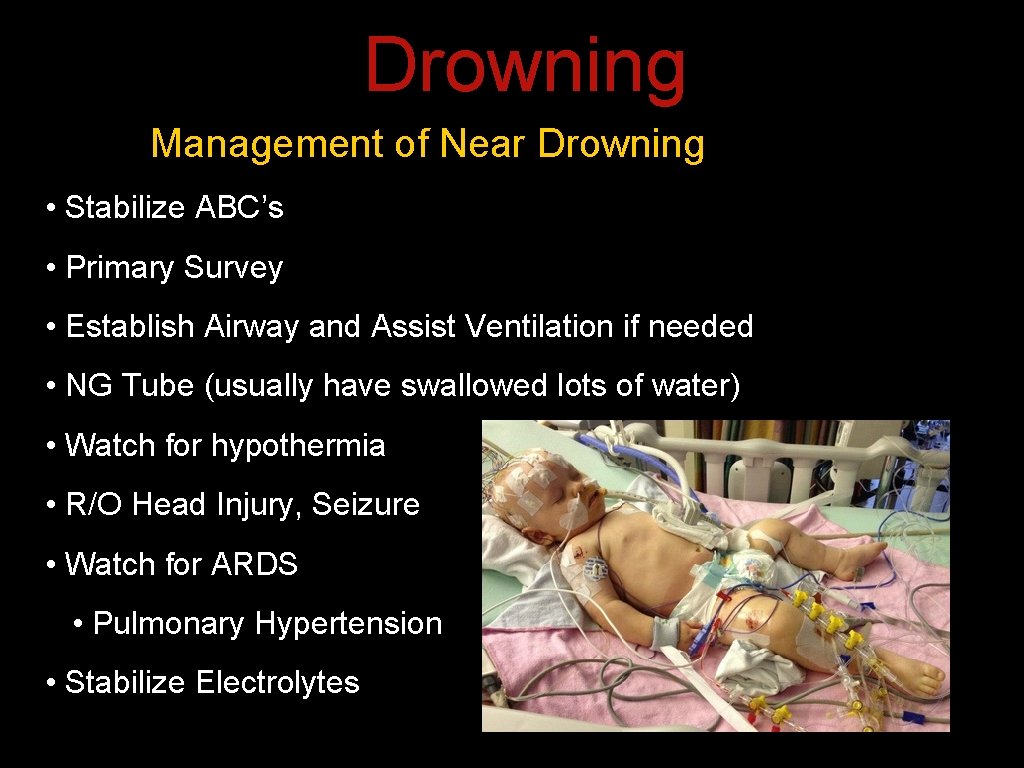 Drowning Management of Near Drowning • Stabilize ABC’s • Primary Survey • Establish Airway Drowning Management of Near Drowning • Stabilize ABC’s • Primary Survey • Establish Airway