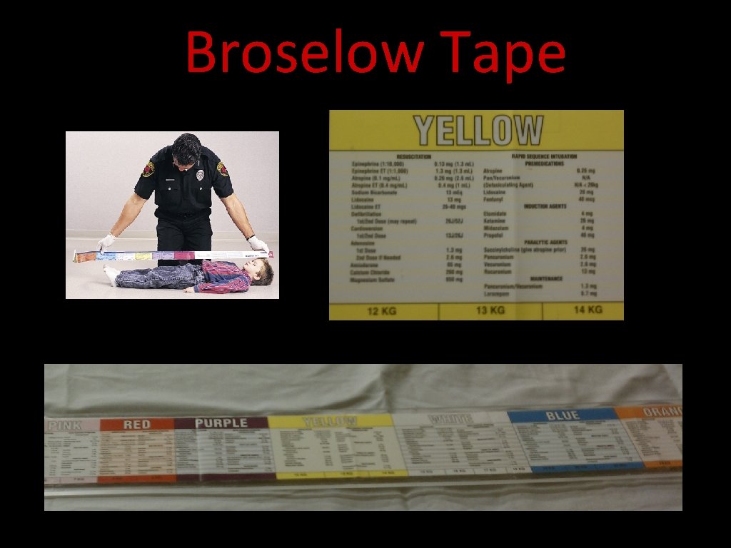 Broselow Tape Broselow Tape