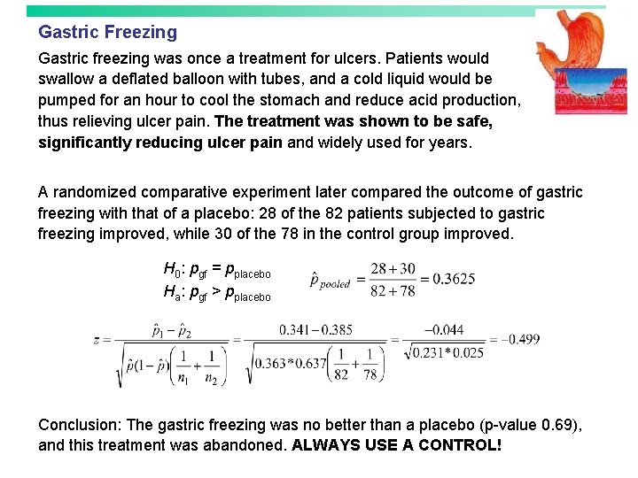 Gastric Freezing Gastric freezing was once a treatment for ulcers. Patients would swallow a