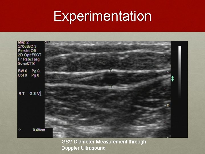 Experimentation GSV Diameter Measurement through Doppler Ultrasound 
