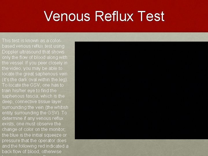 Venous Reflux Test This test is known as a colorbased venous reflux test using