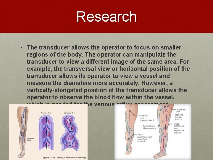 Research • The transducer allows the operator to focus on smaller regions of the