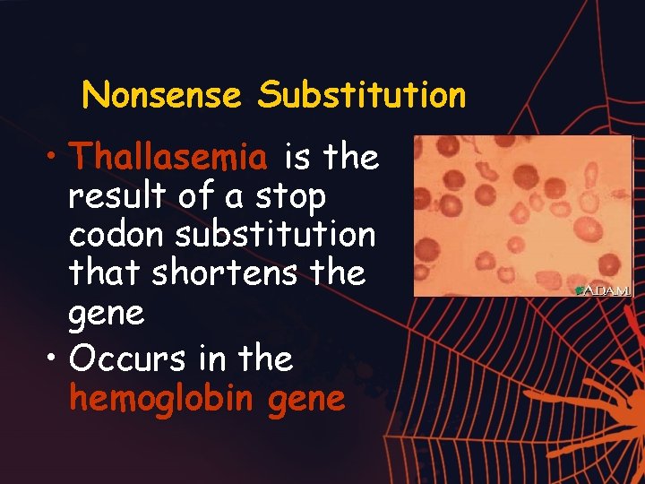 Nonsense Substitution • Thallasemia is the result of a stop codon substitution that shortens