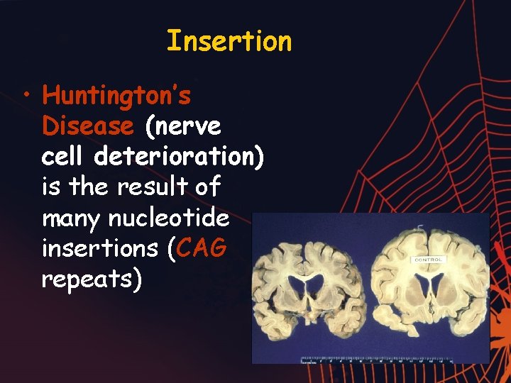 Insertion • Huntington’s Disease (nerve cell deterioration) is the result of many nucleotide insertions