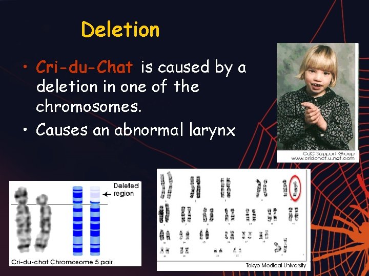 Deletion • Cri-du-Chat is caused by a deletion in one of the chromosomes. •