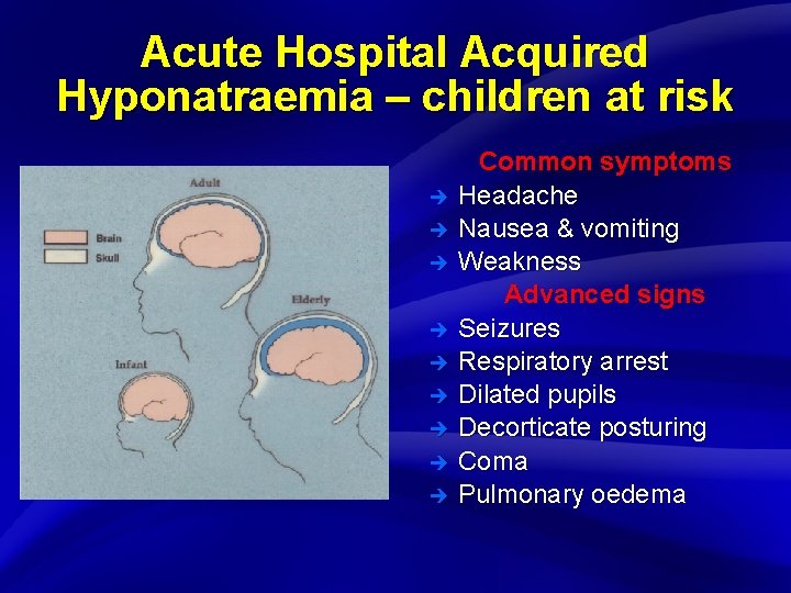 Slide 13 Acute Hospital Acquired Hyponatraemia – children at risk è è è è